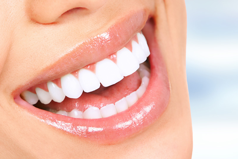 Cosmetic Dentistry in Playa Del Rey